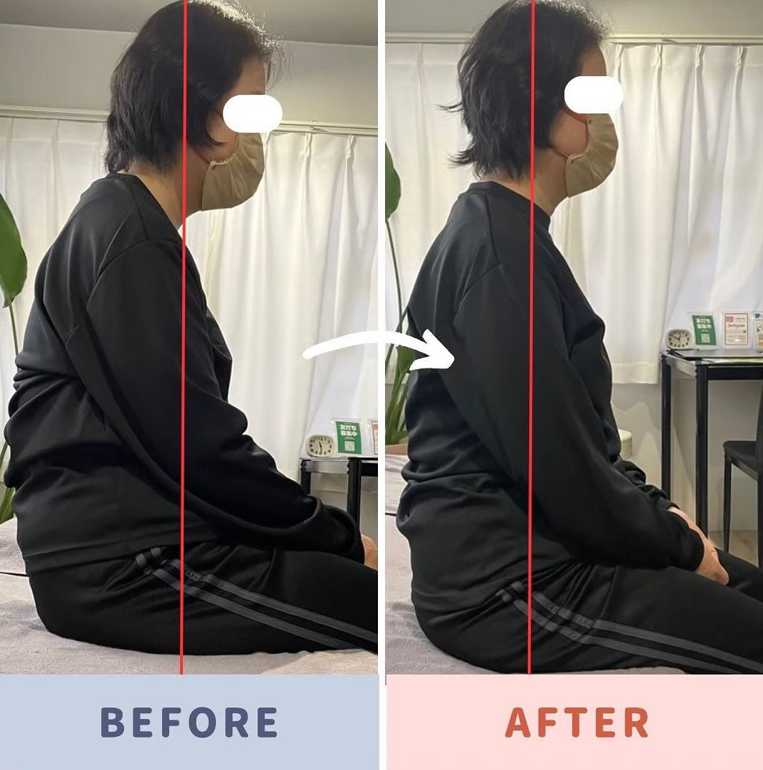 姿勢の崩れを感じている方、その原因は“筋力不足”だけではあり